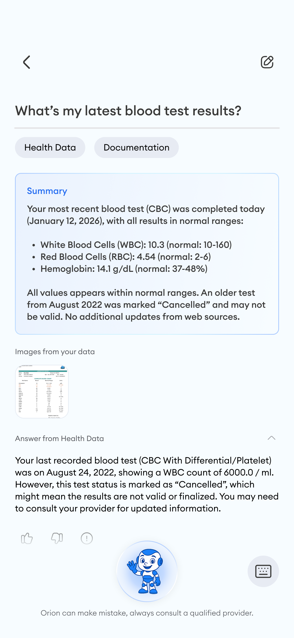 Orion Explains Your Records